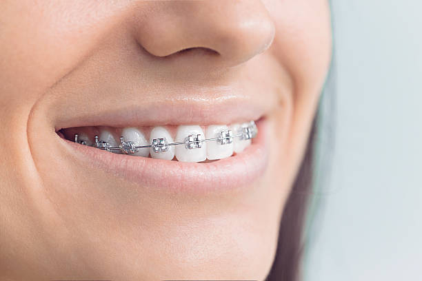 Best Dental Inlays and Onlays  in Dacula, GA